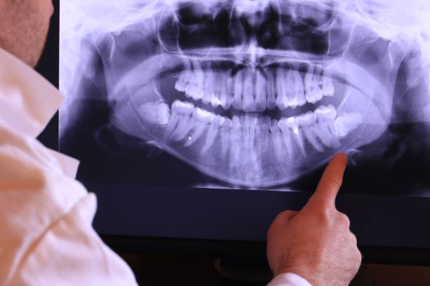 Best Emergency Dentist for Special Needs Patients in Tyro, NC