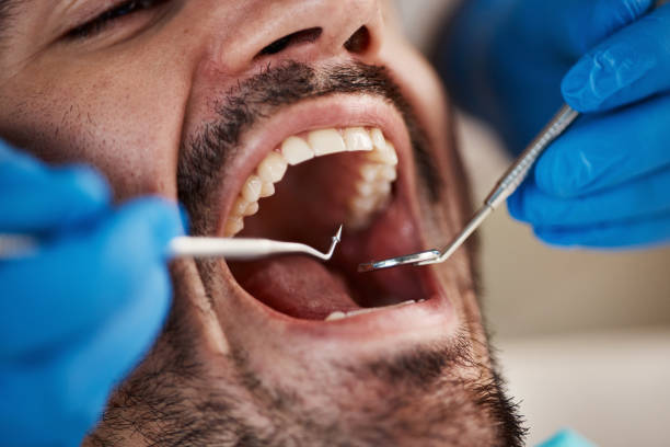  Tyro, NC Emergency Dentist Pros