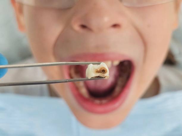 Best Weekend Emergency Dentist in Tyro, NC