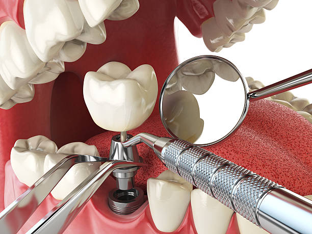 Best Urgent Dental Care for Toothache in Tyro, NC