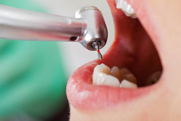 Best Emergency Cosmetic Dentistry in Tyro, NC